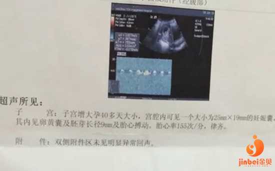 供卵代生孩子产子的流程,【正规医院有供卵吗】预产期当天出生，1.28顺产6.3斤